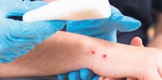 Posjeduju adekvatne količine antiviperinog seruma